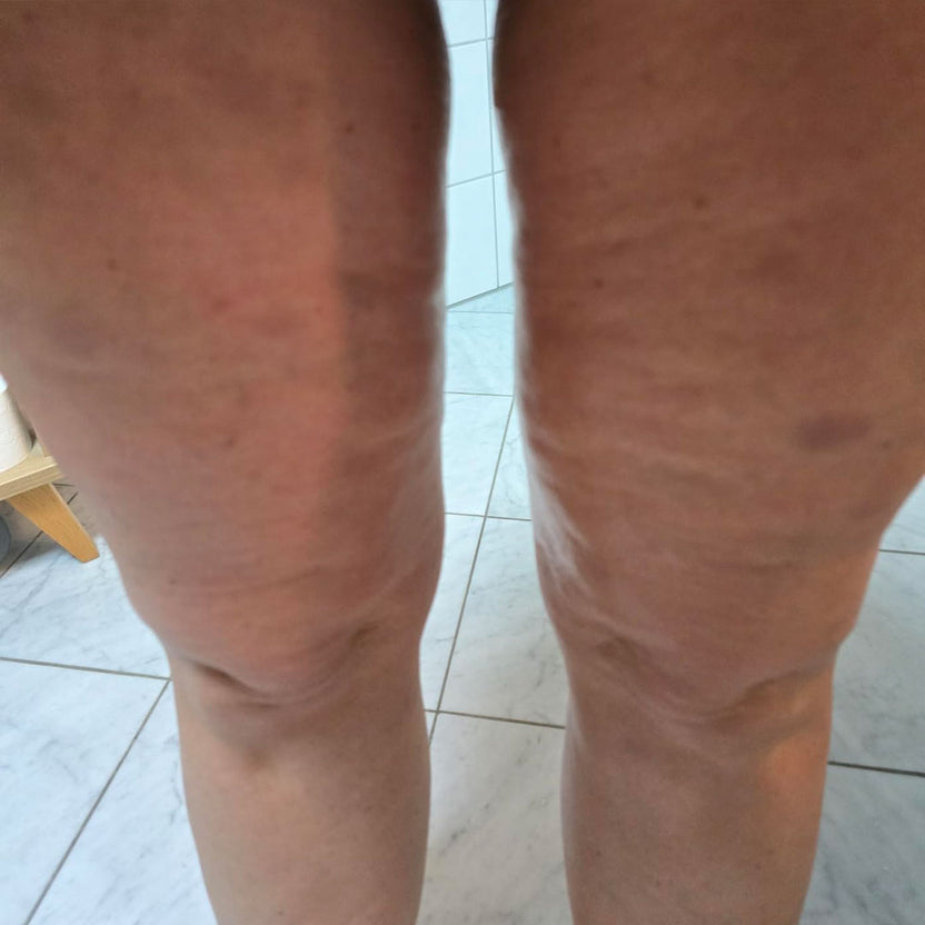 image comparison before